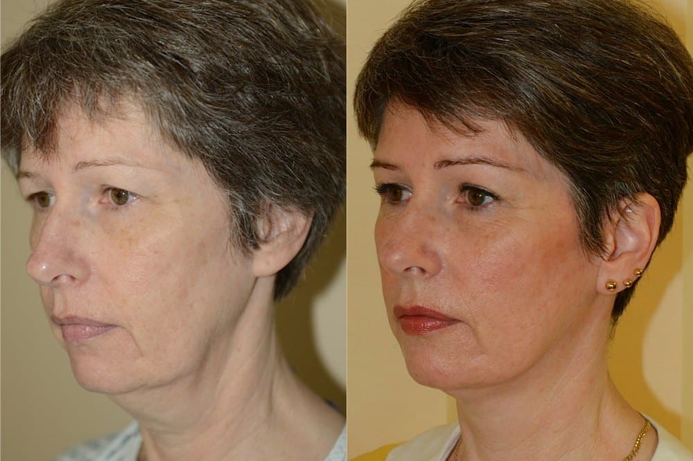 facial plastic surgery scotland