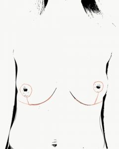 anchor breast uplift