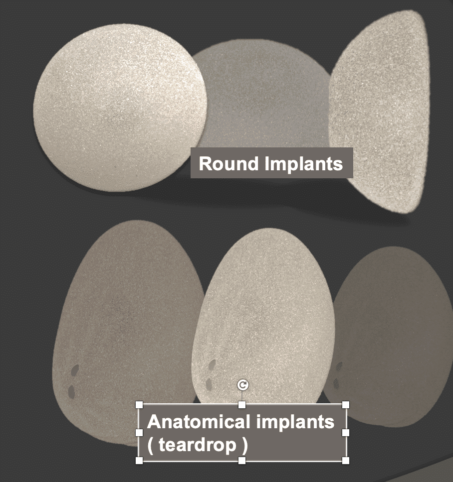 different shapes of breast implants